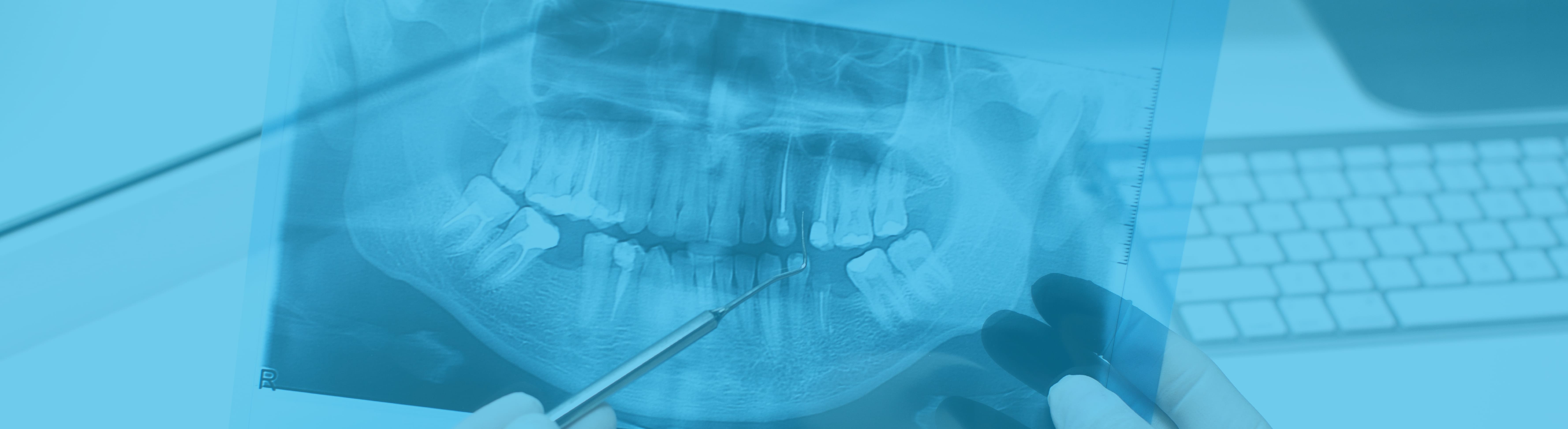 Banner de Endodoncia